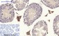 CD44 Polyclonal Antibody